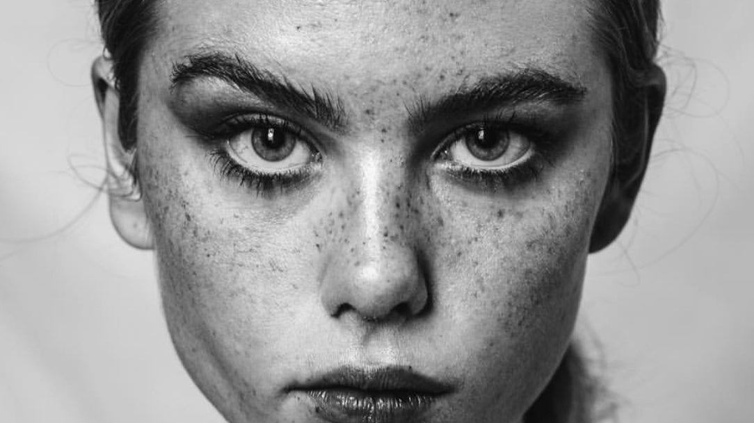 How To Get Freckles