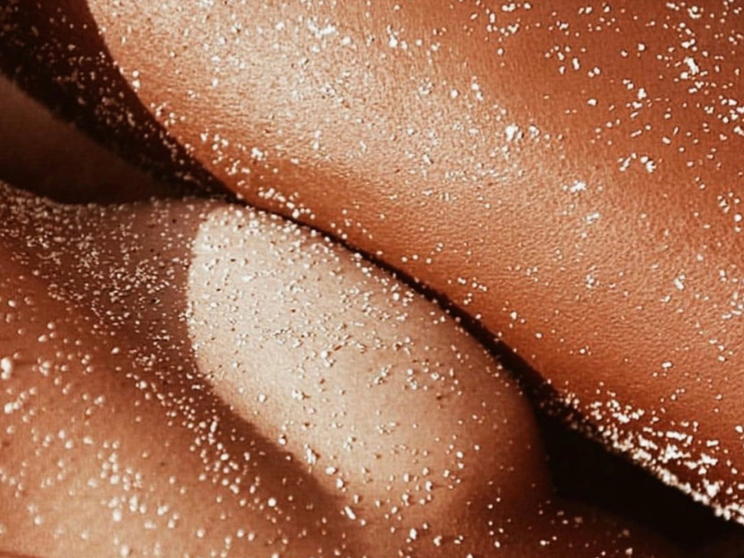 So You Got Burned.. Now What