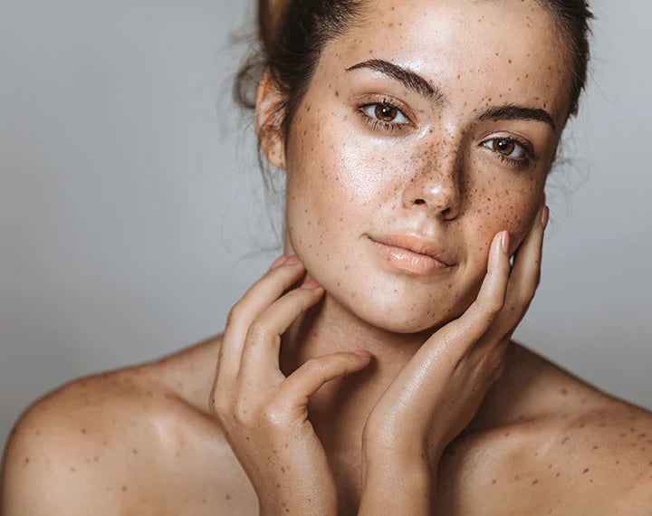 Top 5 Celebrities with Freckles