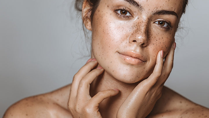 Top 5 Celebrities with Freckles