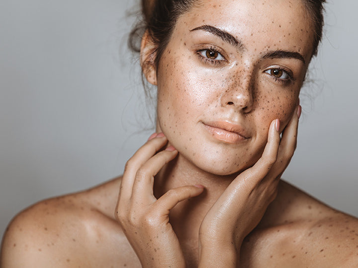 Top 5 Celebrities with Freckles