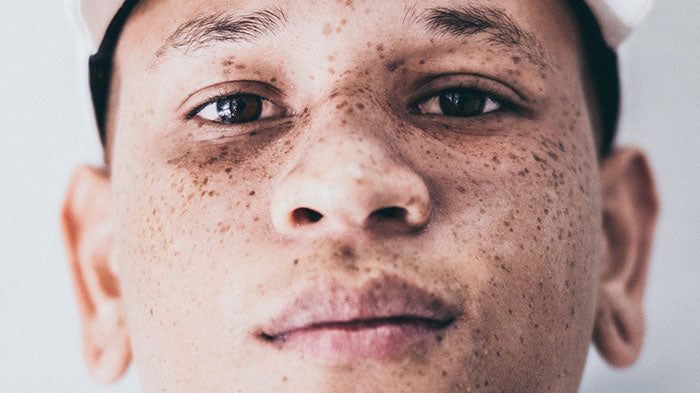 Freckle Makeup for Men