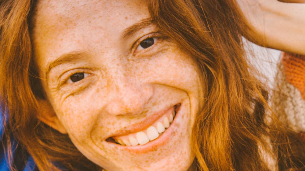 How To Get Instant Freckles